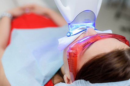 In-office teeth whitening treatment