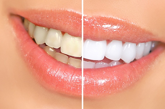 The cost of your cosmetic dentistry treatment depends on many factors