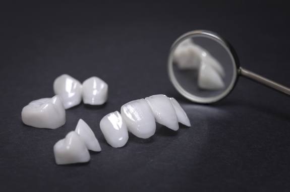Several dental veneers on flat surface next to dental mirror