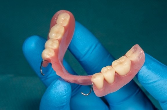 Gloved hand holding a partial denture