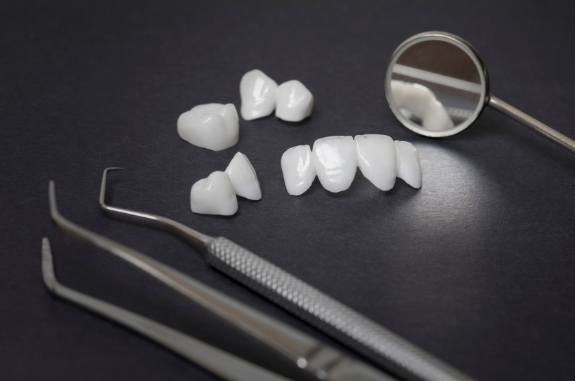 Several Lumineers laying on table next to dental instruments