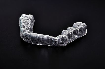 Occlusal splint against black background