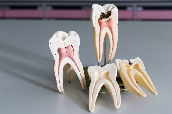 Four models of teeth on table