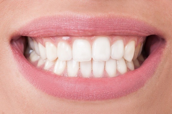 Close up of bright smile after teeth whitening in Clute